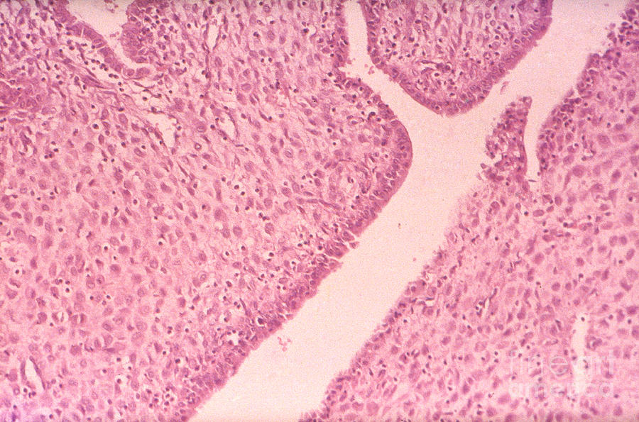 Decidual Cells Lm Photograph by M. I. Walker