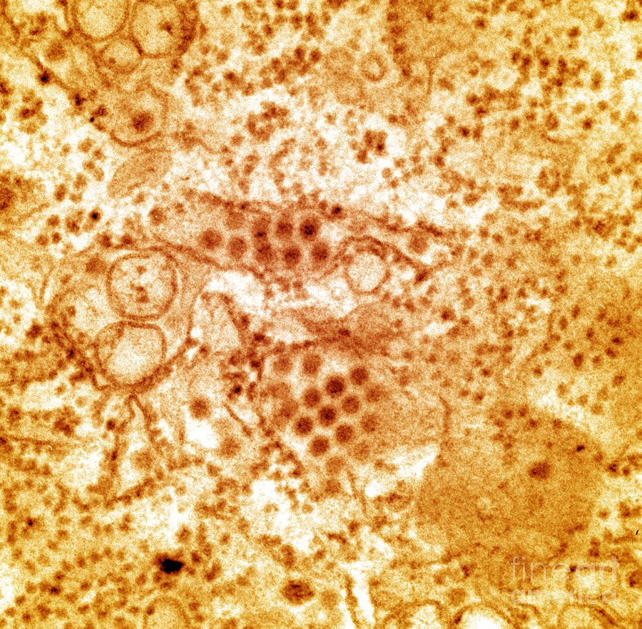 Dengue Virus, Tem Photograph by Science Source
