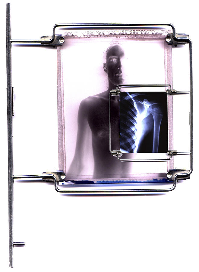Skeleton Photograph - Diagnostic Imaging by Neal Grundy