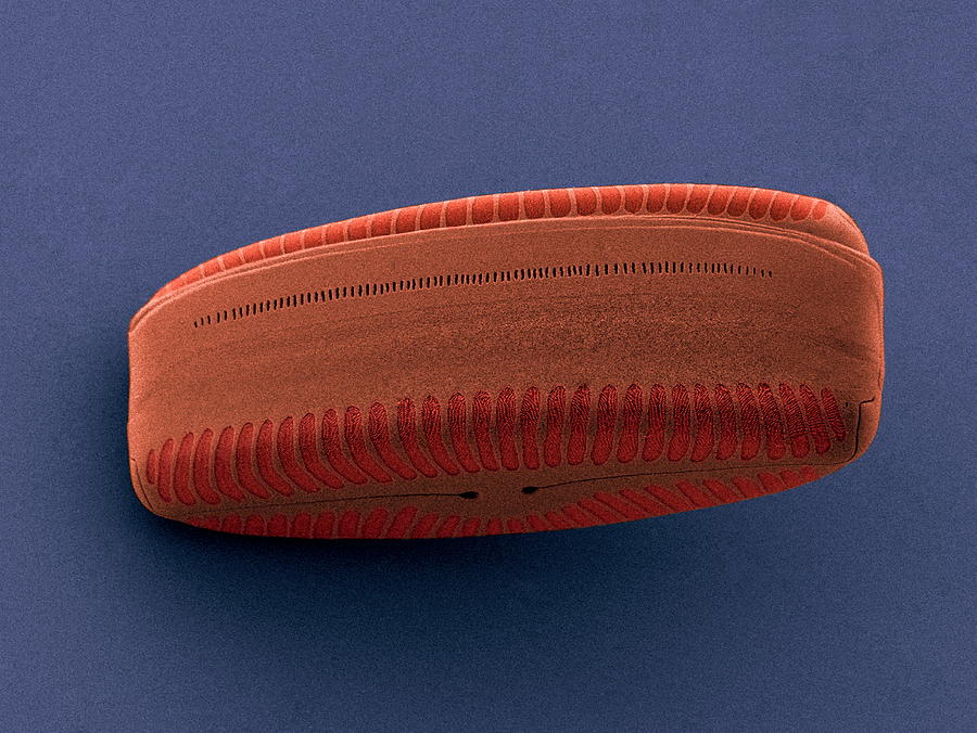 Nature Photograph - Diatom, Sem by Steve Gschmeissner