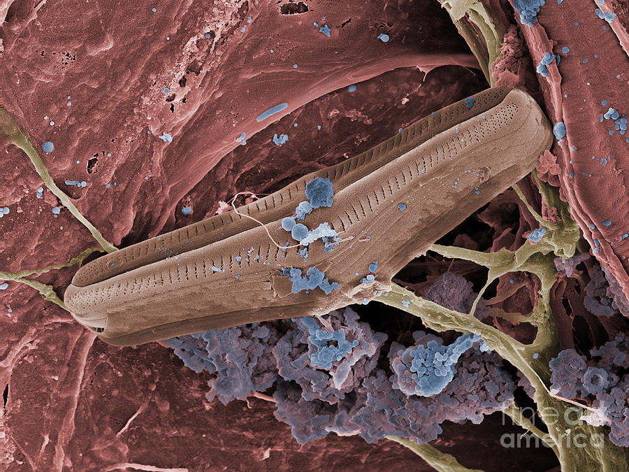 Diatom With Thermophilic Bacteria Photograph by Ted Kinsman