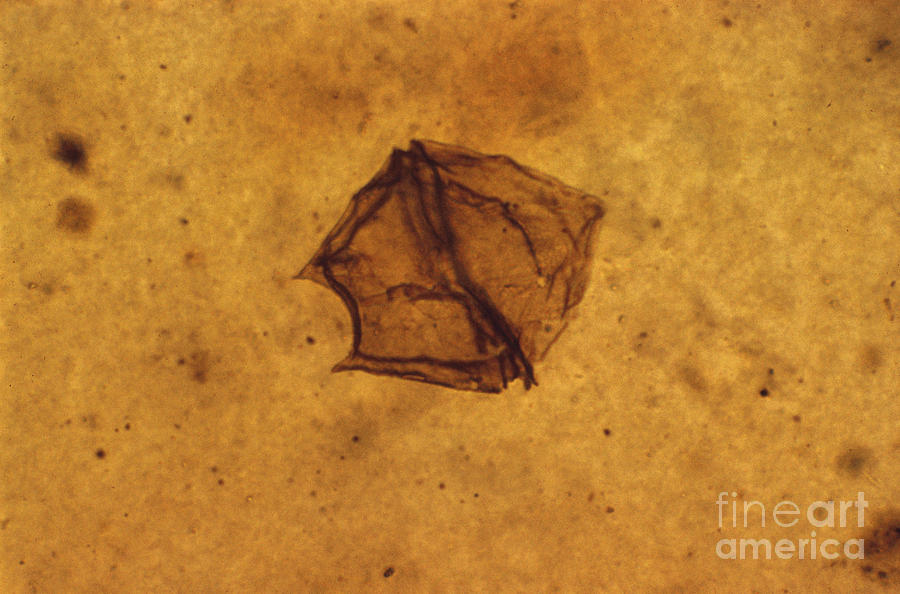 Dinoflagellate Fossil Photograph by Eric V Grave