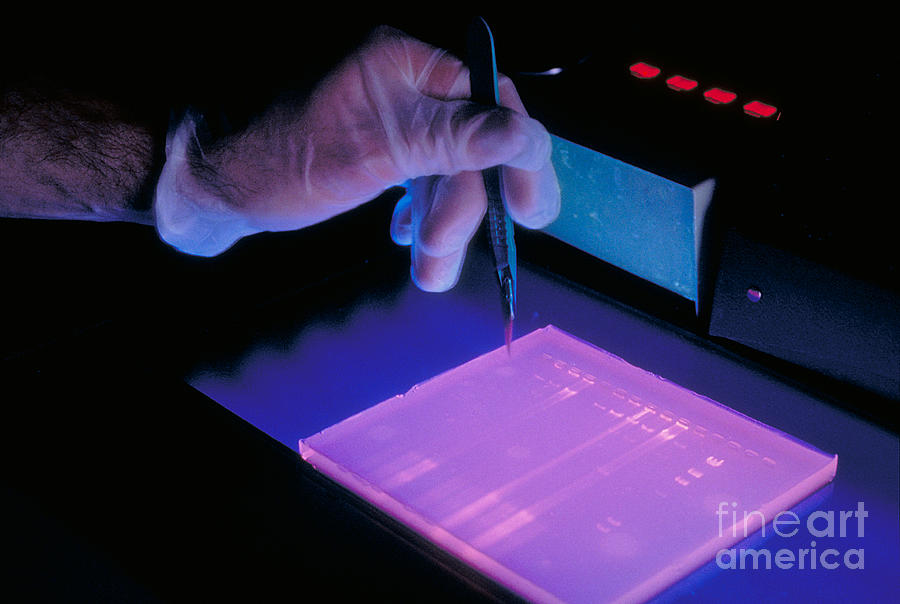 Dna Study Using Electrophoresis Photograph by Science Source