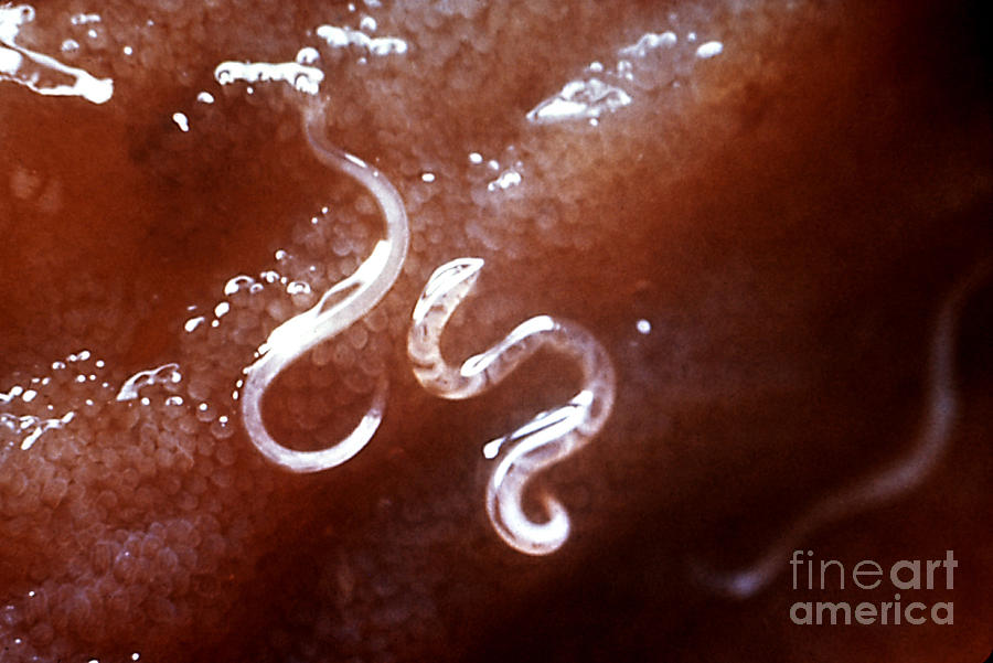 Ancylostoma Caninum Photograph - Dog Hookworm by Science Source
