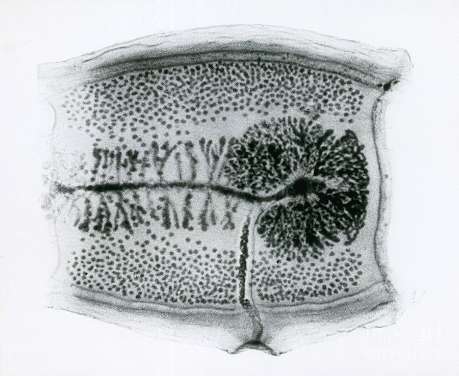 Animal Photograph - Dog Tapeworm Taenia Pisiformis by Eric V. Grave