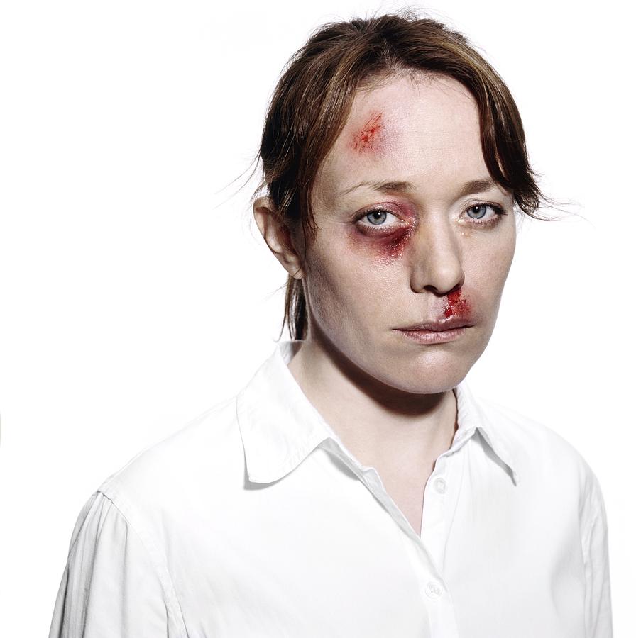 Human Photograph - Domestic Violence by Kevin Curtis