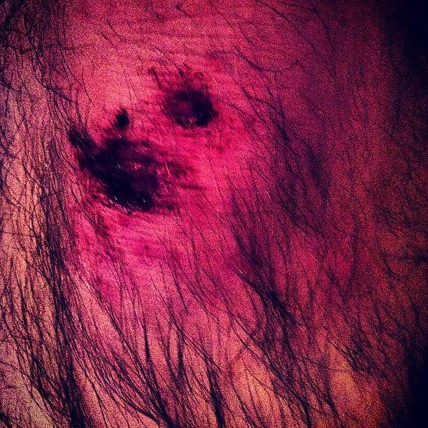 Knee Photograph - #drunk #knee #scab by Kiss My Kunst