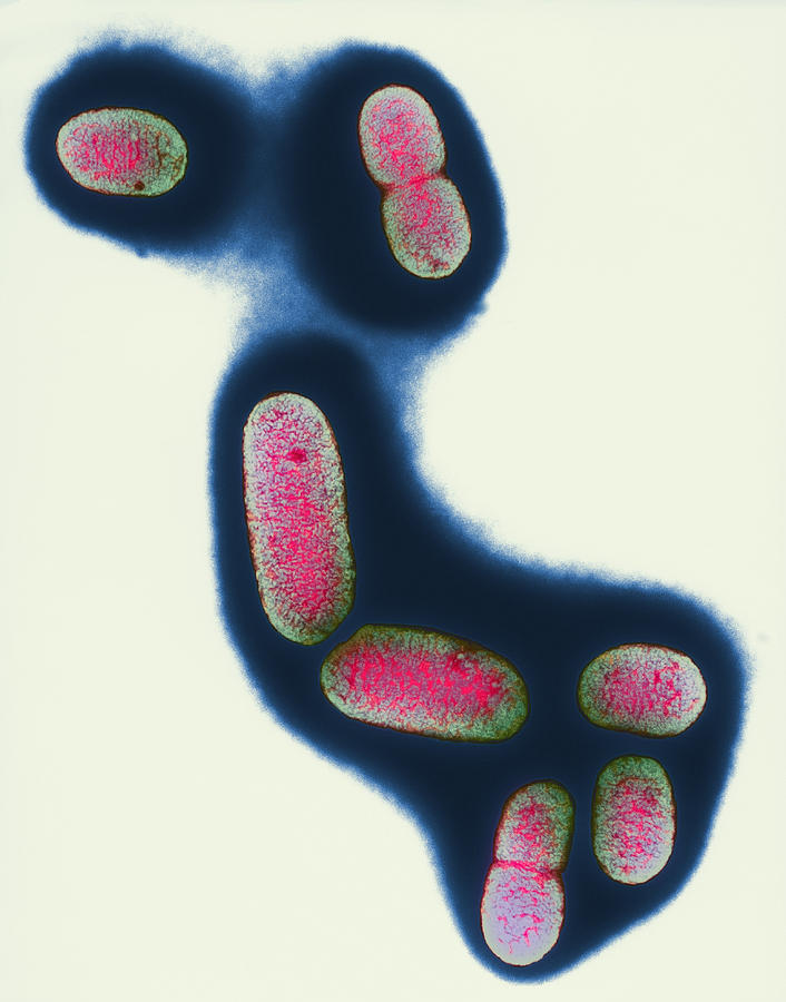 E Coli Bacteria Photograph By Dr Kari Lounatmaa Fine Art America