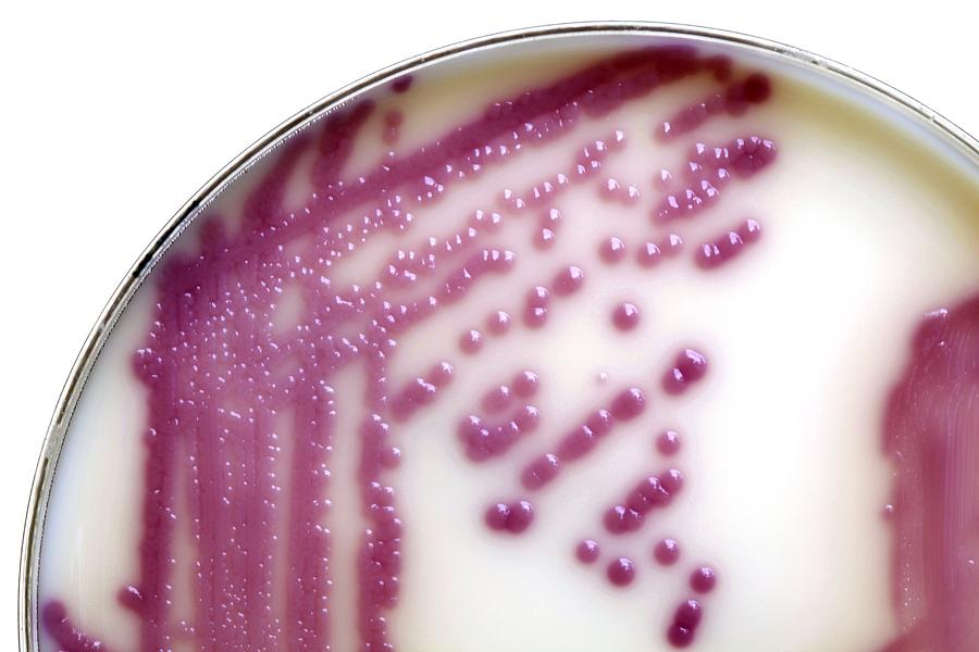 E. Coli Bacteria In A Petri Dish Photograph by Doncaster And Bassetlaw ...