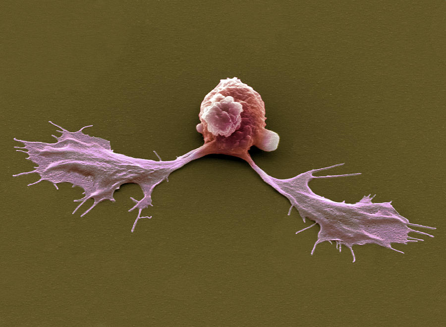 Embryonic Stem Cell Photograph - Embryonic Stem Cells, Sem by Steve Gschmeissner