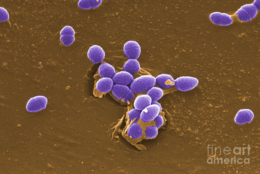 Enterococcus Faecalis Bacteria, Sem Photograph by Science Source