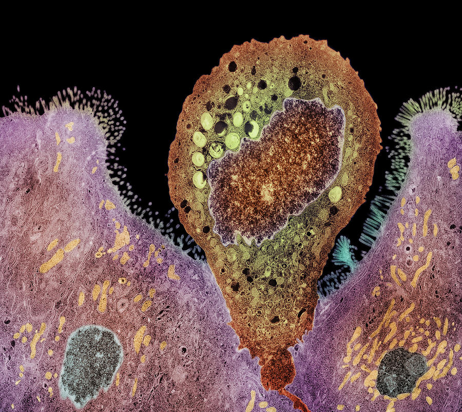 Wildlife Photograph - Enterocytozoon Sp. Parasite, Coloured Tem by London School Of Hygiene & Tropical Medicine
