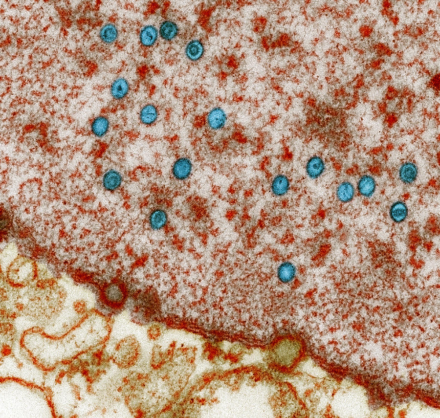 Epstein-barr Virus Particles, Tem Photograph by Steve Gschmeissner ...