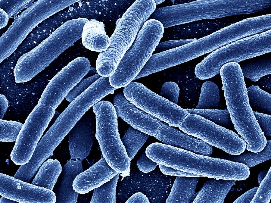 Bacillus Photograph - Escherichia Coli Bacteria, Sem by Pasieka