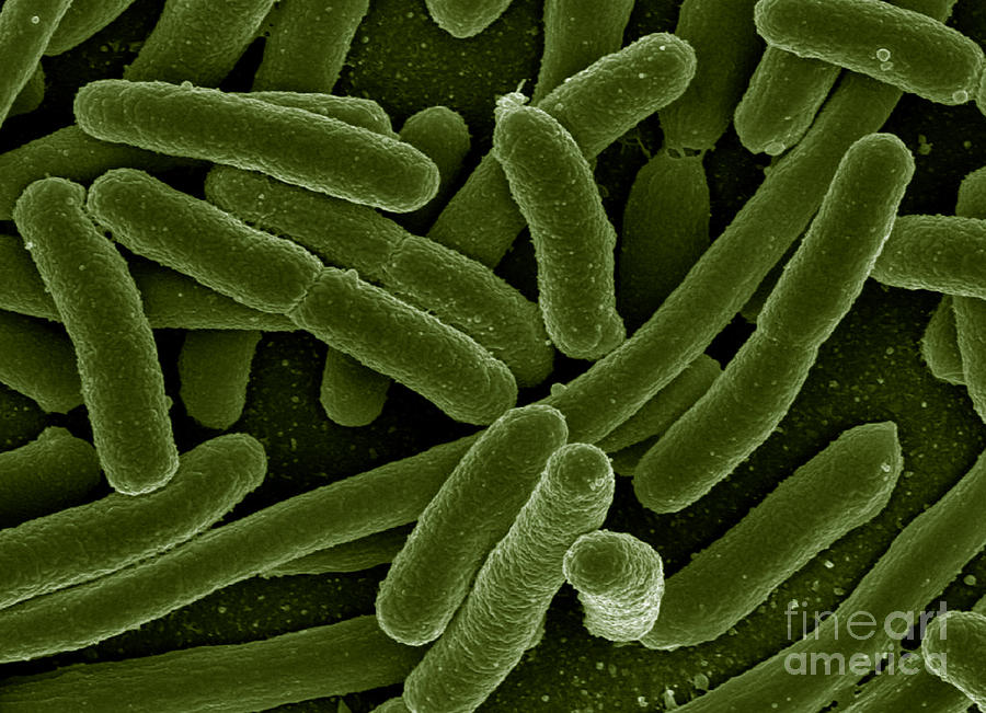 Microbiology Photograph - Escherichia Coli Bacteria, Sem by Science Source