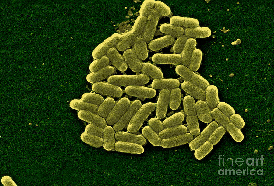 Escherichia Coli O157h7 Bacteria, Sem Photograph by Science Source