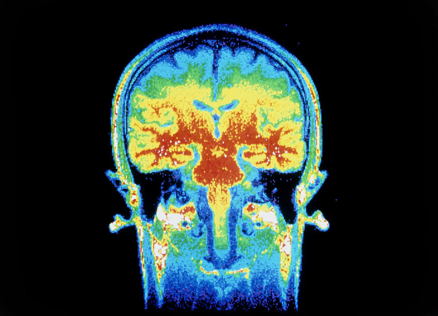 False-colour Nmr Scan Of The Head, Frontal Section Photograph by Cnri ...