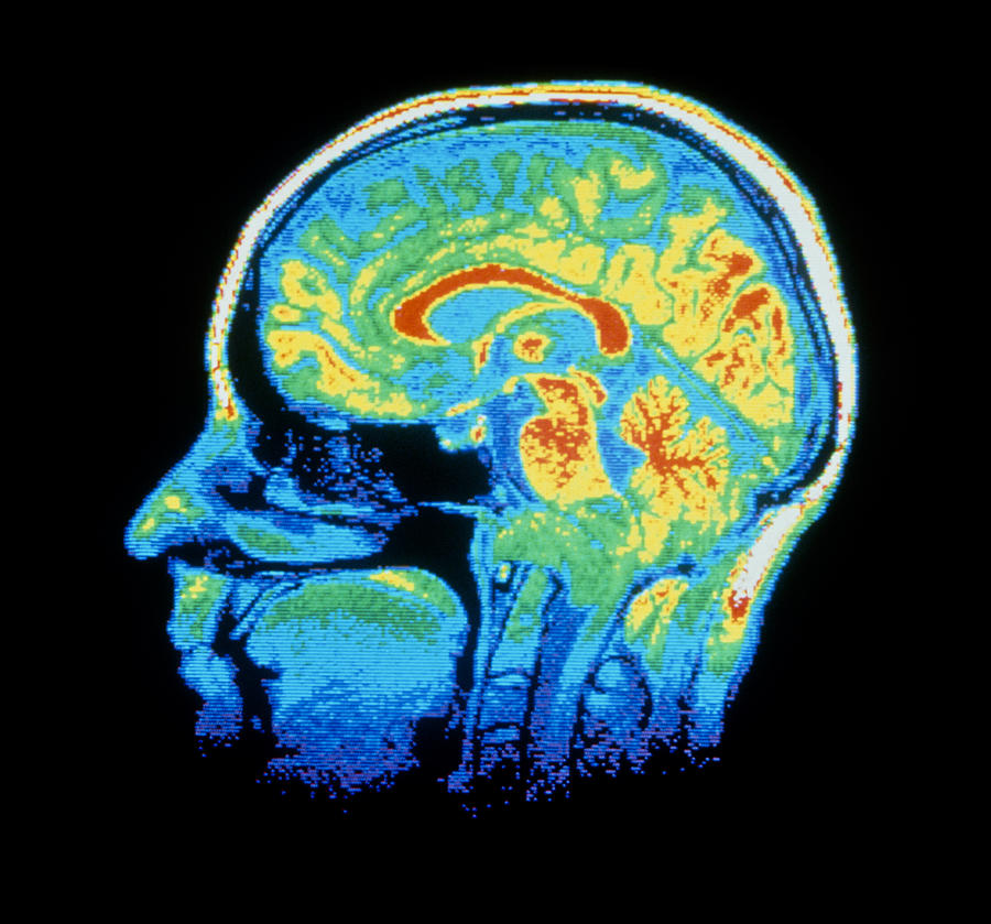 False-colour Nmr Scan Of The Head, Sagittal Slice Photograph by Cnri ...