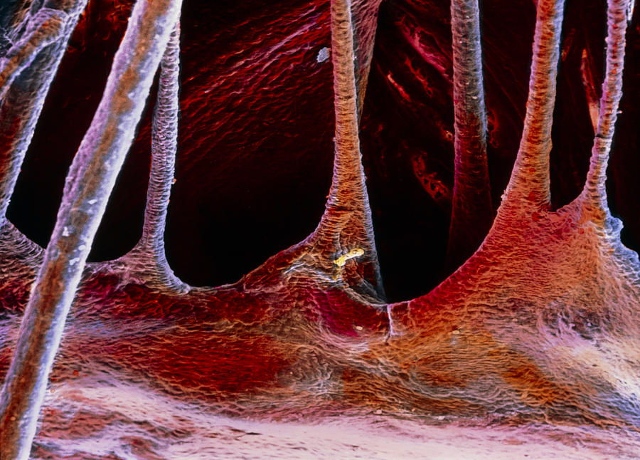 Valve Photograph - False-colour Sem Of A Portion Of A Cardiac Valve by Prof. P. Mottadept. Of Anatomyuniversity \la Sapienza\, Rome