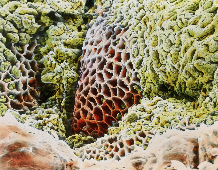 Images Photograph - False-colour Sem Of Gastric Ulcer by Prof. P. Mottadept. Of Anatomyuniversity \la Sapienza\, Rome