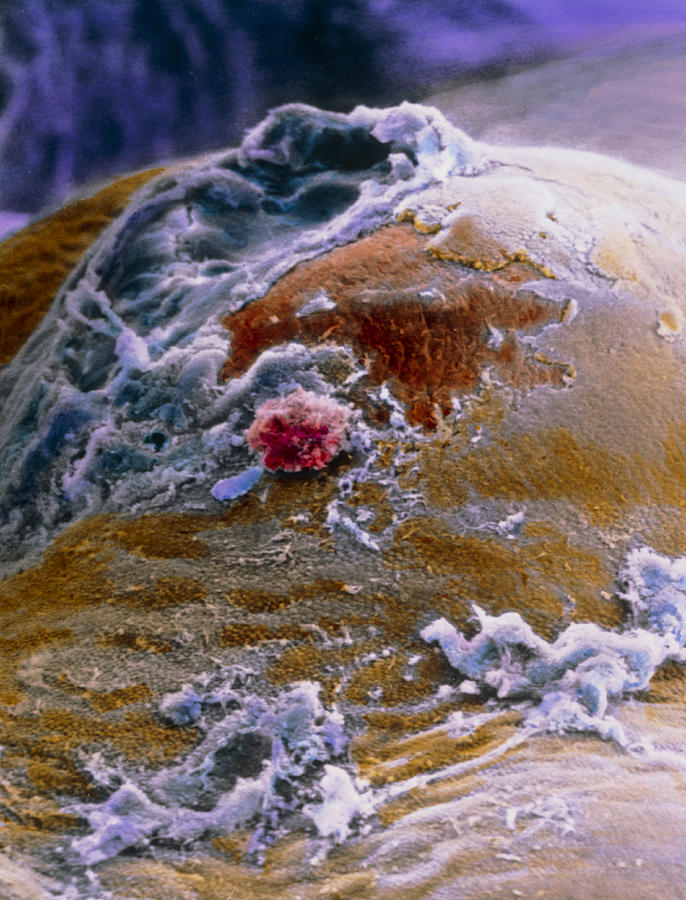Egg Photograph - False-colour Sem Of The Ovary Surface At Ovulation by Professors P.m. Motta & J. Van Blerkom