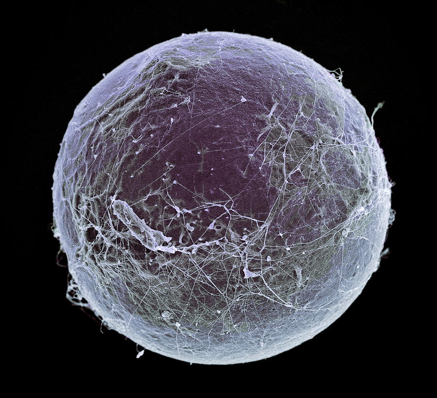 Round Shape Photograph - Fat Cell, Sem by Steve Gschmeissner