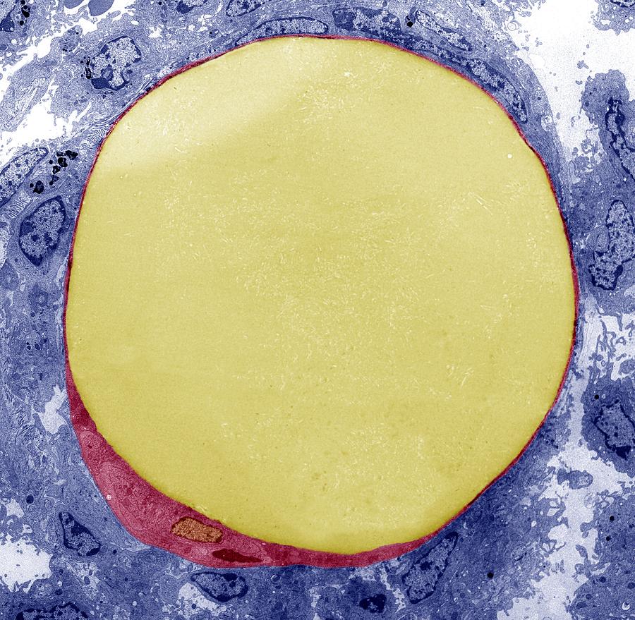 fat cell shape