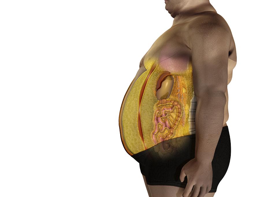 Fat On Inner Organs, Artwork Photograph by Claus Lunau