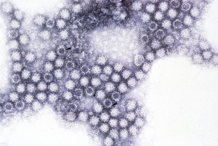 Feline Calicivirus Tem Photograph by Science Source