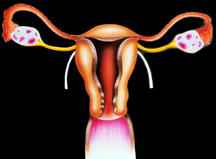 Illustration Photograph - Female Reproductive Organs by Francis Leroy, Biocosmos