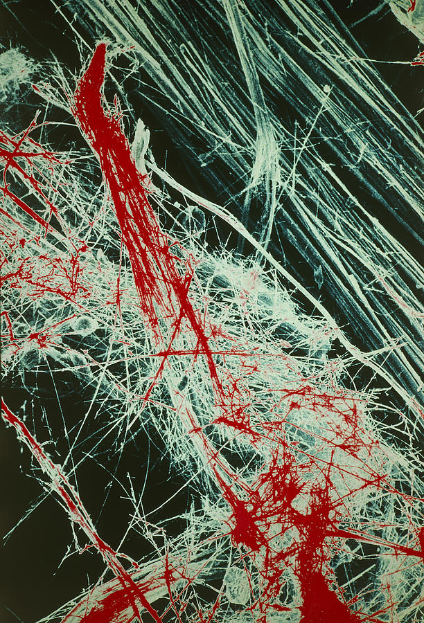 Fibres Of Blue Asbestos Photograph by Dr Jeremy Burgess.