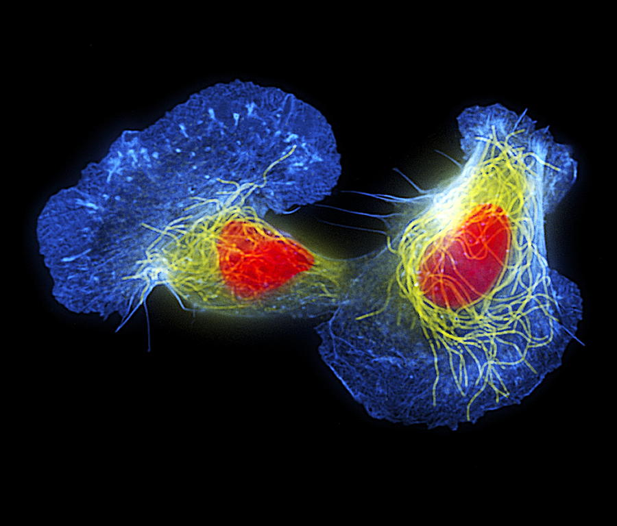 Fish Skin Cells Photograph by Dr Torsten Wittmann