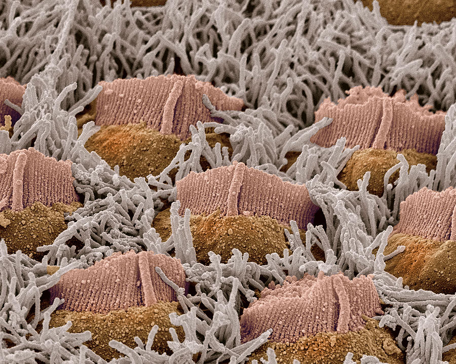 Foetal Inner Ear Hair Cells, Sem Photograph by Steve Gschmeissner ...