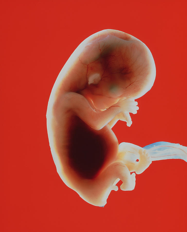 foetus-at-11-weeks-photograph-by-garry-watson-fine-art-america