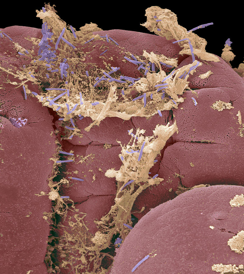 Small Intestine Photograph - Food & Bacteria In The Ileum, Sem by Steve Gschmeissner