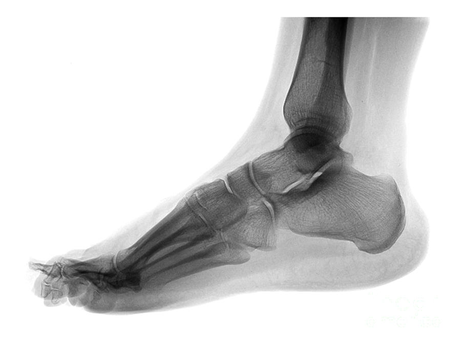 Foot Photograph by Medical Body Scans
