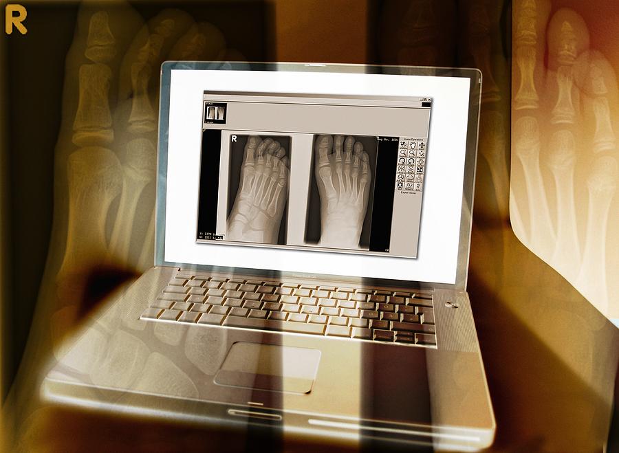 Foot Photograph - Foot X-rays On A Laptop Computer, Artwork by Miriam Maslo
