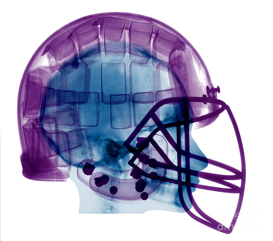 Sports Photograph - Football Helmet X-ray by Ted Kinsman