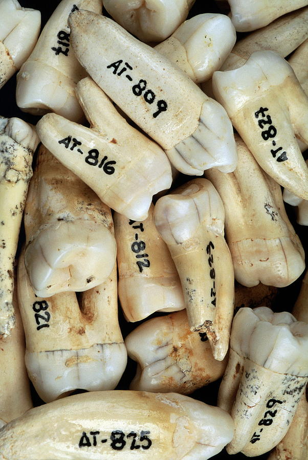 Unique Photograph - Fossilised Teeth, Sima De Los Huesos by Javier Truebamsf