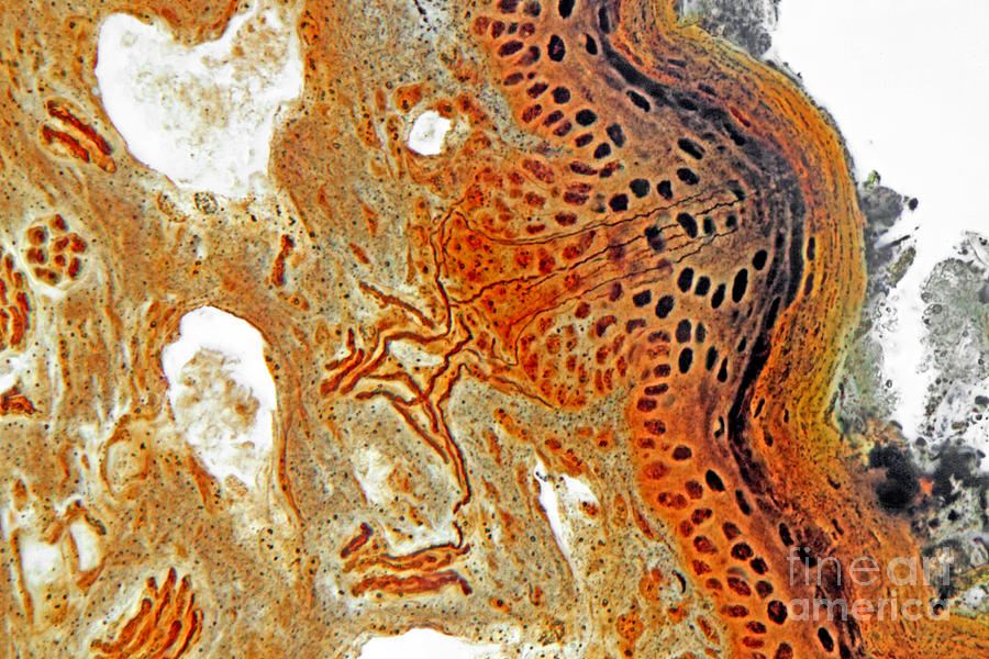Histology Photograph - Free Nerve-endings, Epidermis by M I Walker