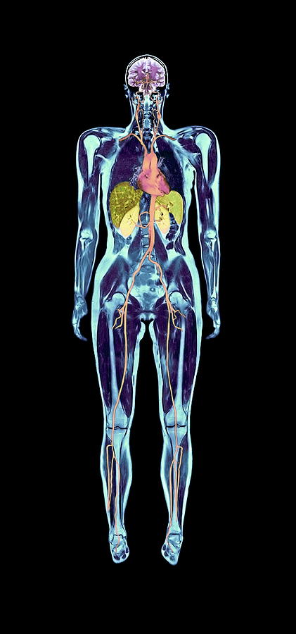 Whole body scans - Stock Image - P835/0057 - Science Photo Library