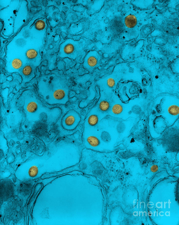 Arbovirus Photograph - Ganjam Virus by Science Source