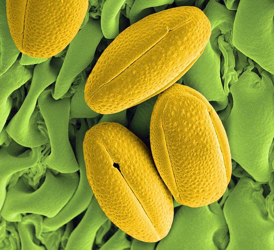 Nature Photograph - Gorse Pollen Grains, Sem by Peter Bond, Em Centre, University Of Plymouth
