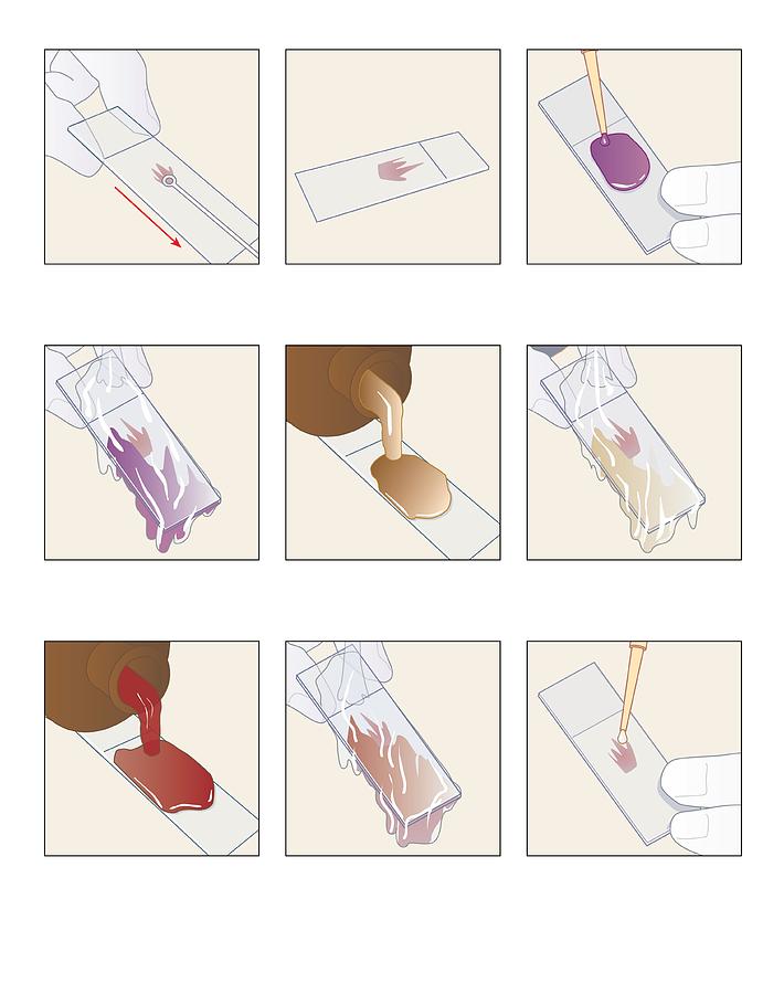 Staining Gram Stain Procedure