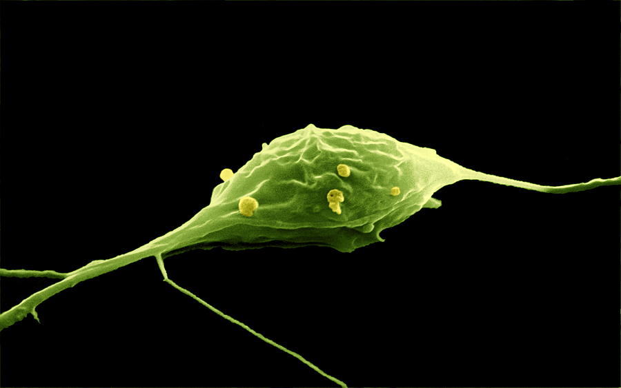 Granule Cell Photograph - Granule Nerve Cell, Sem by David Mccarthy