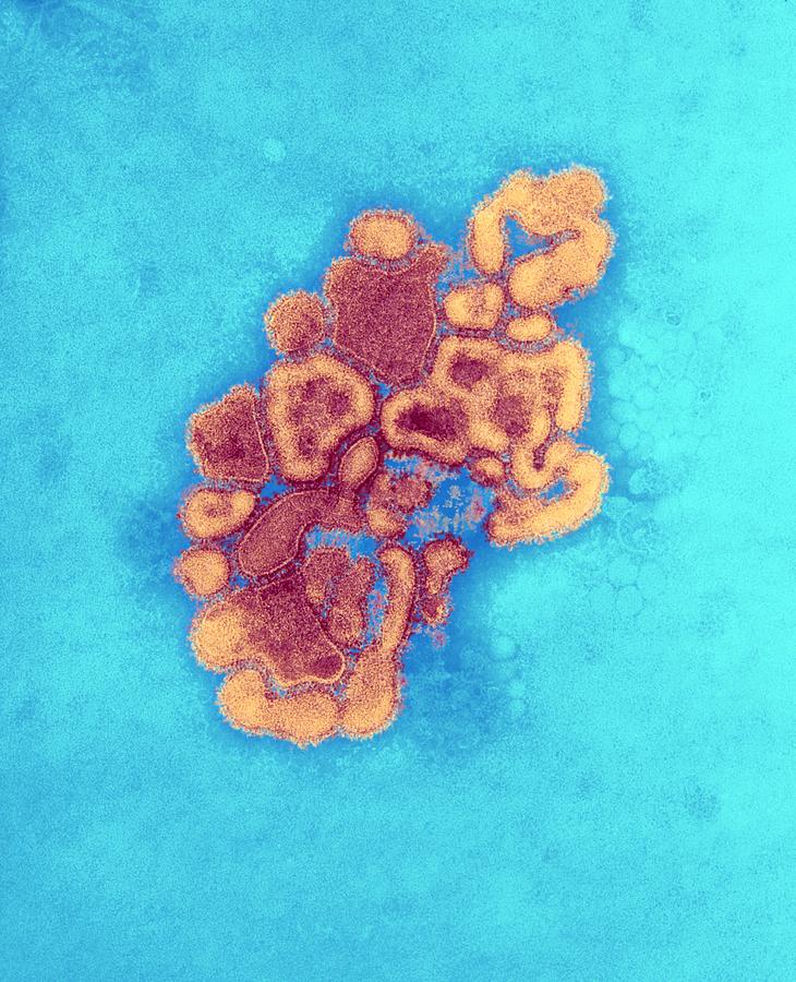 H1n1 1976 Swine Flu Virus Tem Photograph By Ami Images Fine Art America