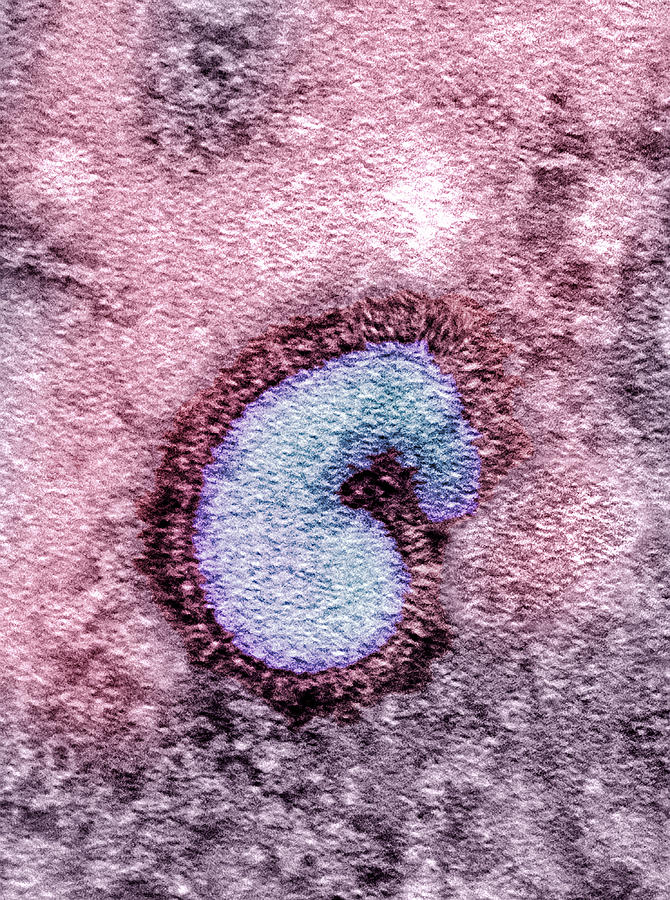 H5n1 Avian Influenza Virus Particle Tem Photograph By Nibsc Fine Art