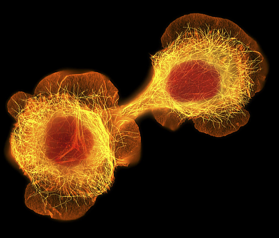 Hacat Cell Photograph - Hacat Culture Cells, Light Micrograph by Dr Torsten Wittmann Hacat Cell Photograph - Hacat Culture Cells, Light Micrograph by Dr Torsten Wittmann