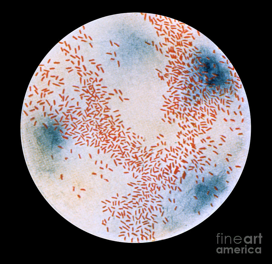 Haemophilus Influenzae Bacteria Photograph by Science Source