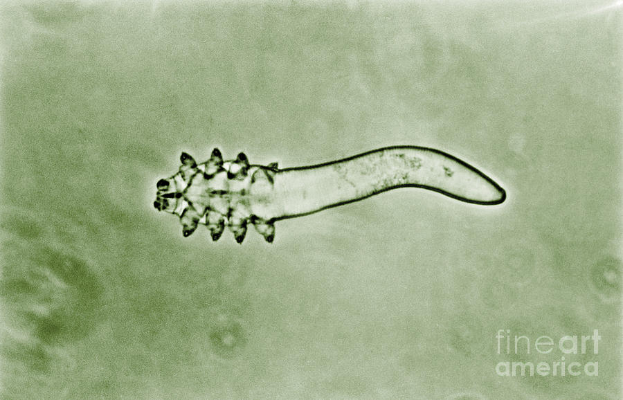 Hair Follicle Mite Photograph by Omikron